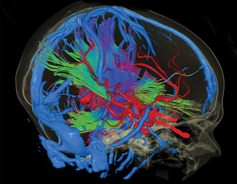 Surgical Theater's virtual reality technology prepares surgeons for patient-specific brain and spine procedures