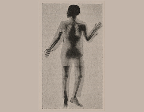 full body x-ray first one happened here_Cleveland_Ohio_Inventors_Inventions_Innovators