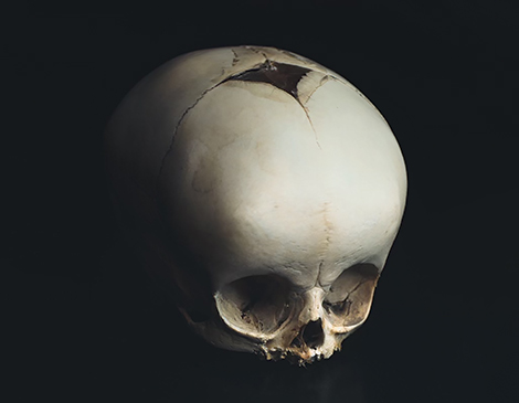 A Skull From Lakewood's Cleveland Curiosities